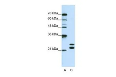 Anti-CSDC2 antibody, N-term used in Western Blot (WB). GTX47321