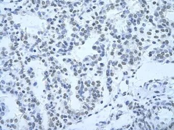 Anti-HNRPH3 antibody, N-term used in IHC (Paraffin sections) (IHC-P). GTX47329