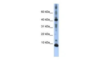 Anti-LSM6 antibody, N-term used in Western Blot (WB). GTX47332