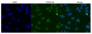 Anti-CPSF6 antibody, Internal used in Immunocytochemistry/ Immunofluorescence (ICC/IF). GTX47333