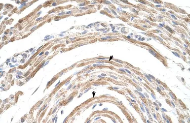Anti-CPSF6 antibody, Internal used in IHC (Paraffin sections) (IHC-P). GTX47333
