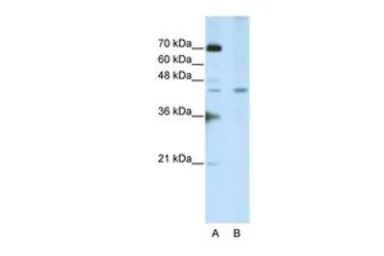 Anti-SURF6 antibody, Internal used in Western Blot (WB). GTX47336