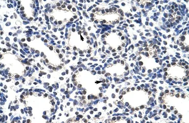 Anti-POP4 antibody, C-term used in IHC (Paraffin sections) (IHC-P). GTX47339