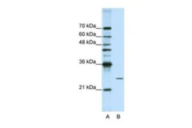Anti-POP4 antibody, C-term used in Western Blot (WB). GTX47339