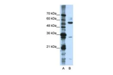 Anti-KHDRBS3 antibody, C-term used in Western Blot (WB). GTX47342