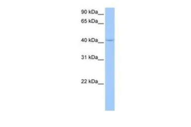 Anti-PAIP1 antibody, N-term used in Western Blot (WB). GTX47345