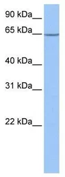 Anti-NOL5A antibody, Internal used in Western Blot (WB). GTX47347