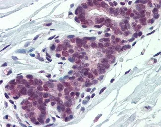 Anti-PCBP1 antibody, Internal used in IHC (Paraffin sections) (IHC-P). GTX47349