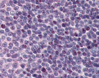 Anti-PCBP1 antibody, Internal used in IHC (Paraffin sections) (IHC-P). GTX47349