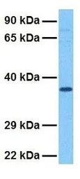 Anti-PCBP1 antibody, Internal used in Western Blot (WB). GTX47349