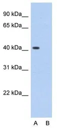 Anti-PCBP1 antibody, Internal used in Western Blot (WB). GTX47350