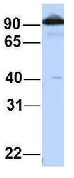Anti-CTAGE5 antibody, Internal used in Western Blot (WB). GTX47355