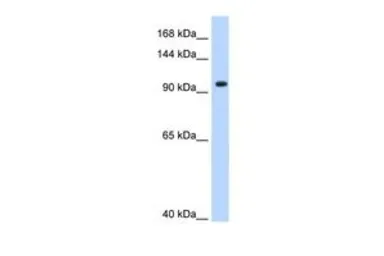 Anti-SF3A1 antibody, N-term used in Western Blot (WB). GTX47357