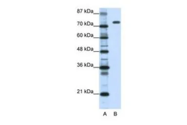 Anti-Nucleolin antibody, C-term used in Western Blot (WB). GTX47363