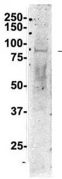 Anti-Nucleolin antibody, C-term used in Western Blot (WB). GTX47363