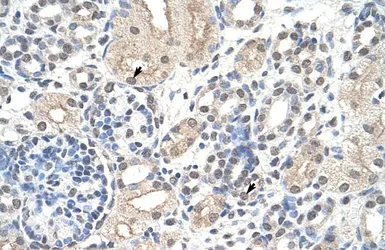 Anti-Nucleolin antibody, N-term used in IHC (Paraffin sections) (IHC-P). GTX47364
