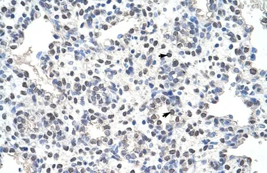 Anti-Nucleolin antibody, N-term used in IHC (Paraffin sections) (IHC-P). GTX47364