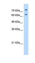 Anti-Nucleolin antibody, N-term used in Western Blot (WB). GTX47364