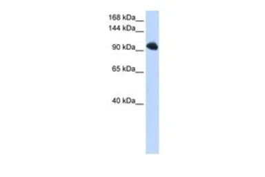 Anti-SFRS8 antibody, N-term used in Western Blot (WB). GTX47368