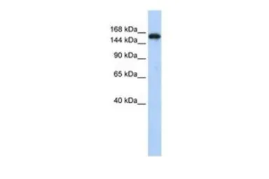 Anti-Synaptojanin 1 antibody, N-term used in Western Blot (WB). GTX47370