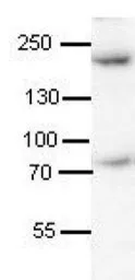 Anti-Synaptojanin 1 antibody, N-term used in Western Blot (WB). GTX47370