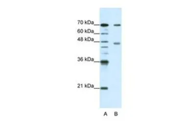 Anti-PABPC4 antibody, N-term used in Western Blot (WB). GTX47371