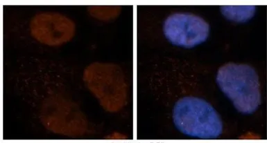 Anti-EIF3G antibody, Internal used in Immunocytochemistry/ Immunofluorescence (ICC/IF). GTX47377