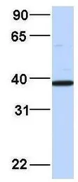Anti-EIF3G antibody, Internal used in Western Blot (WB). GTX47377