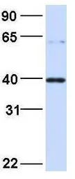 Anti-EIF3G antibody, Internal used in Western Blot (WB). GTX47377