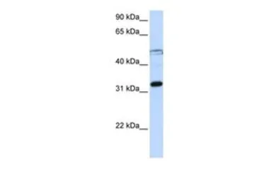 Anti-EIF3G antibody, Internal used in Western Blot (WB). GTX47377