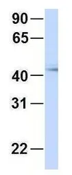 Anti-RTCD1 antibody, N-term used in Western Blot (WB). GTX47378