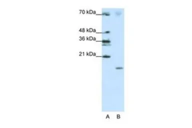 Anti-SRP19 antibody, Internal used in Western Blot (WB). GTX47380