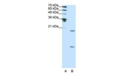 Anti-SNRPF antibody, N-term used in Western Blot (WB). GTX47383