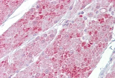 Anti-OAS1 antibody, N-term used in IHC (Paraffin sections) (IHC-P). GTX47393