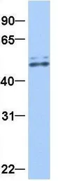 Anti-GRSF1 antibody, Internal used in Western Blot (WB). GTX47396