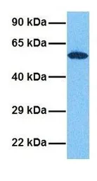 Anti-GRSF1 antibody, Internal used in Western Blot (WB). GTX47396