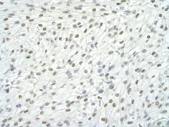 Anti-RBM9 antibody, Internal used in IHC (Paraffin sections) (IHC-P). GTX47400