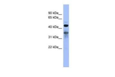 Anti-RBM9 antibody, Internal used in Western Blot (WB). GTX47400
