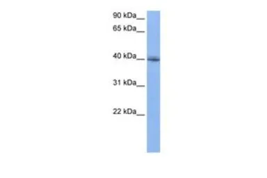 Anti-RBM9 antibody, N-term used in Western Blot (WB). GTX47402