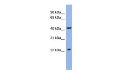Anti-SLC35F1 antibody, N-term used in Western Blot (WB). GTX47403