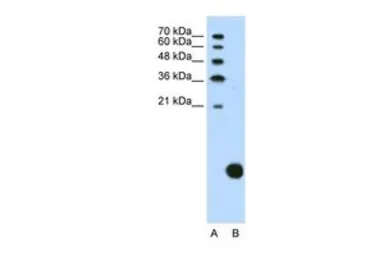 Anti-RPS29 antibody, N-term used in Western Blot (WB). GTX47404
