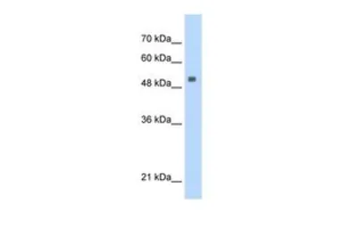 Anti-SERBP1 antibody, Internal used in Western Blot (WB). GTX47406