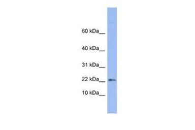 Anti-RPS24 antibody, Internal used in Western Blot (WB). GTX47408