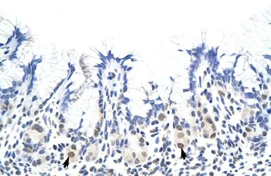 Anti-RP11-78J21.1 antibody, N-term used in IHC (Paraffin sections) (IHC-P). GTX47411