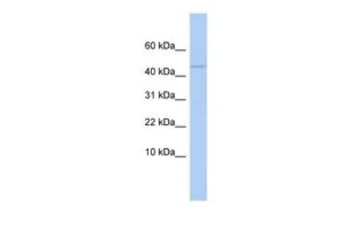 Anti-APOBEC3F antibody, N-term used in Western Blot (WB). GTX47416