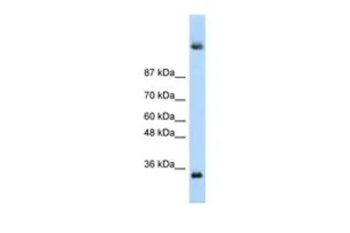 Anti-DAZ4 antibody, N-term used in Western Blot (WB). GTX47419