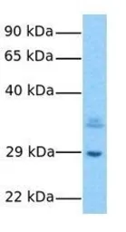 Anti-RPLP0 antibody, Internal used in Western Blot (WB). GTX47426