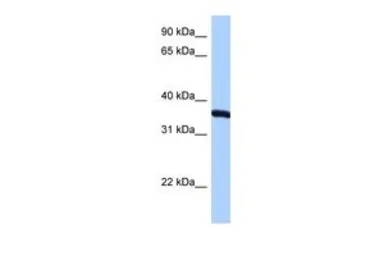 Anti-RPLP0 antibody, N-term used in Western Blot (WB). GTX47427
