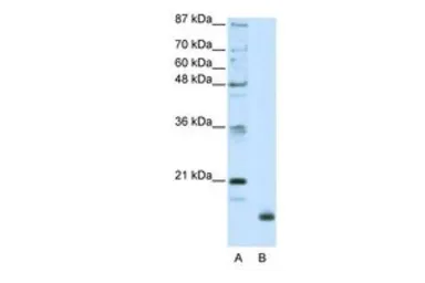 Anti-RPL32 antibody, N-term used in Western Blot (WB). GTX47428