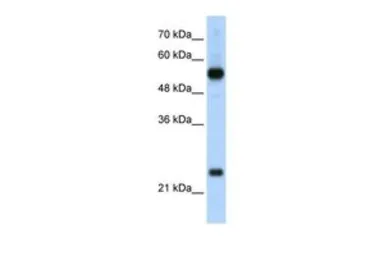 Anti-RPL13 antibody, C-term used in Western Blot (WB). GTX47429